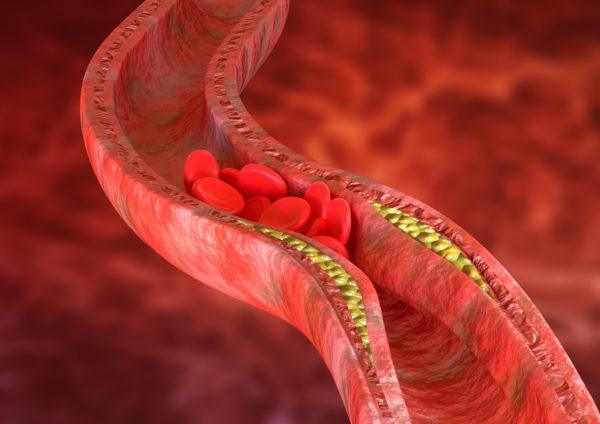 Mejores suplementos controlar colesterol 