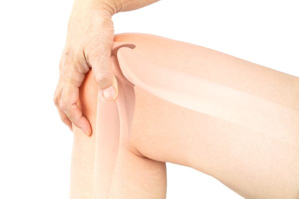 Tendinitis rotuliana sintomas tratamiento prevencion 